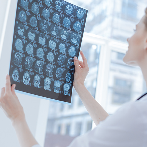 NEUROLOGY